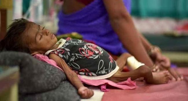 162, 000 Nigerian children died from pneumonia in 2018 - UNICEF