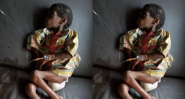 Osun govt rescues malnourished, abandoned 7-yr-old girl accused of being a witch