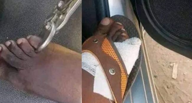 Zimbabweans selling toes $20,000 amid high cost of living