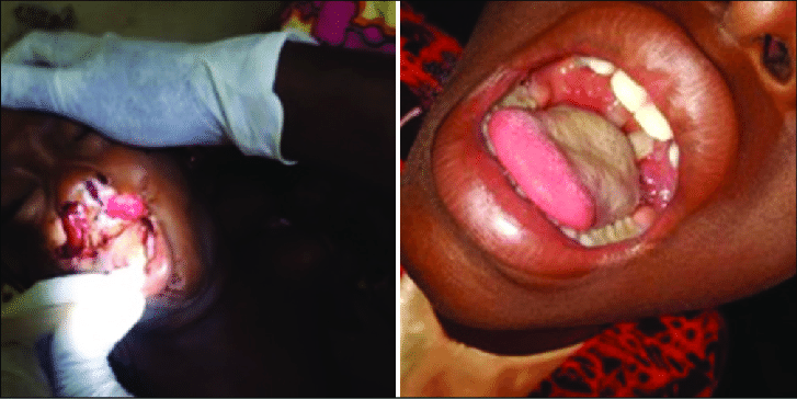 Diphtheria: Kaduna confirms eight deaths, 68 suspected cases